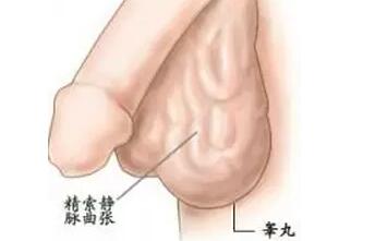 精索靜脈曲張，手術(shù)還是等待？