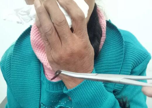 雞皮疙瘩掉一地，鼻子出螞蟥就在你身邊，你還敢喝生水嗎？