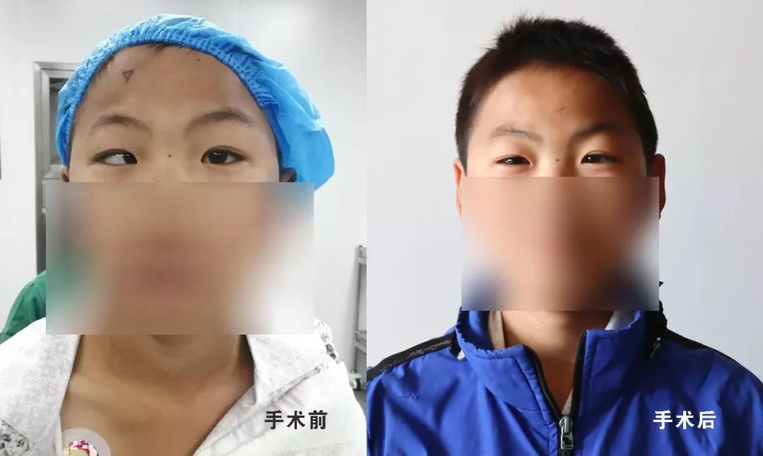 【保山安利醫(yī)院】?jī)和币暿中g(shù)再也不用跑省城了！