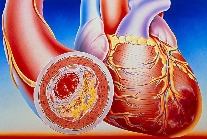 看清心臟動脈，判斷病癥，及早治療冠心病！