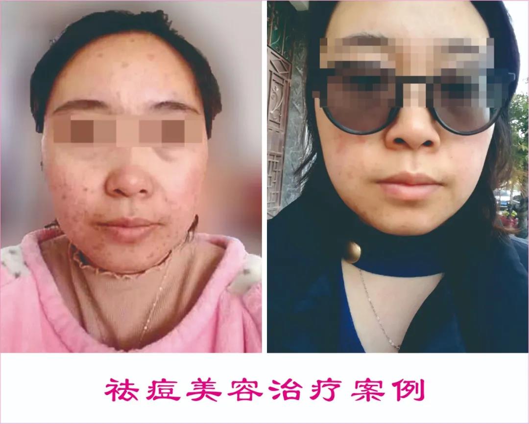 中醫(yī)駐顏，標(biāo)本兼治|中醫(yī)養(yǎng)生駐顏保健治療中心