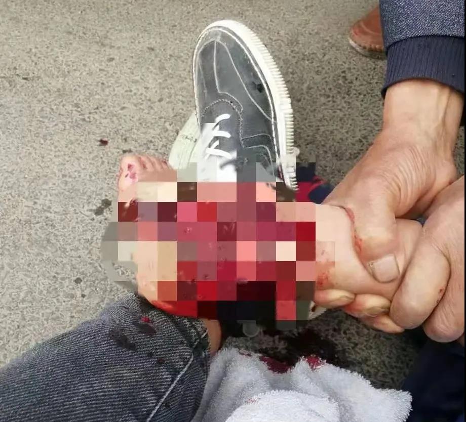 【保山安利醫(yī)院】創(chuàng)傷急救到處跑，不如安利把醫(yī)找！