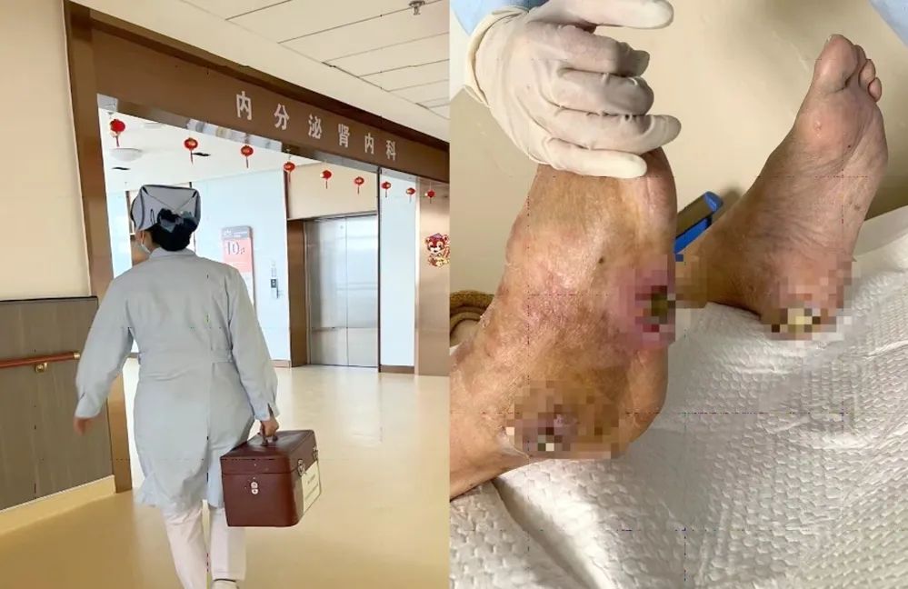 【保山安利醫(yī)院】傷口治療一站式，健康生活零距離！